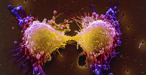 Cancer_Cells